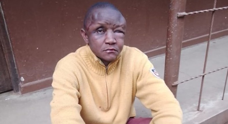 Kileleshwa robbery suspect 