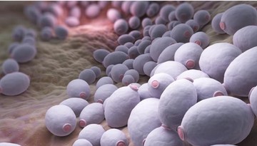 candida gomba, tünetei, candidiásis, szájpenész, cukorbetegség
