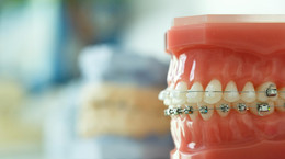 Wady zgryzu i profilaktyka ortodontyczna
