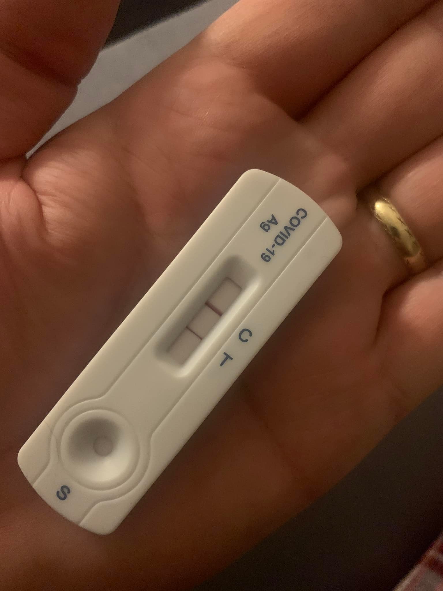 Matovič zverejnil fotku pozitívneho testu.