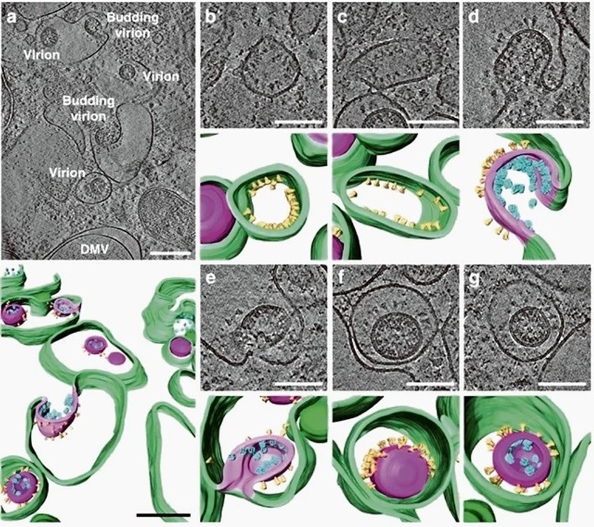 Virus: Zeleno su membrane unutar zaražene ćelije, ljubičasto virusna membrana, a žuto već čuveni šiljak protein virusa korona. A smutljivci kažu da ne postoji...