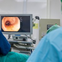 Béltükrözésre megy? Így készüljön fel a kolonoszkópiára