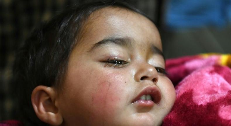 Hiba Jan was hit by a pellet fired from a pump-action gun in Kashmir