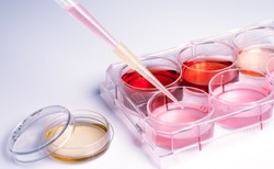 Komórki macierzyste szansą na wyleczenie wielu chorób [WIDEO]