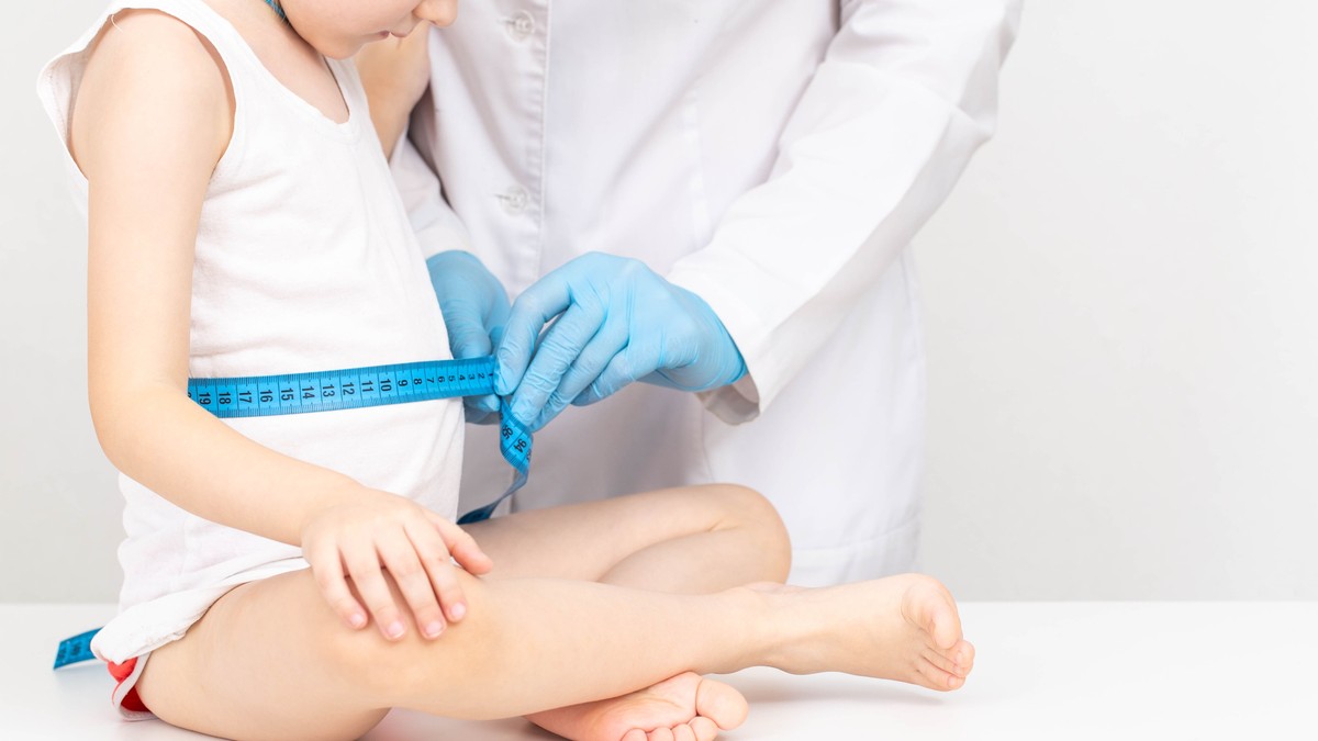 Kvašiorkor je najčešći kod dece, posebno u uzrastu od 3 do 5 godina