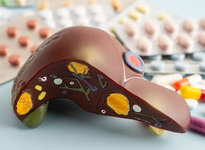Zsírmáj: visszafordíthatja-e egy egyszerű vitamin a világ leggyakoribb májbetegségét? című cikk nyitóképe