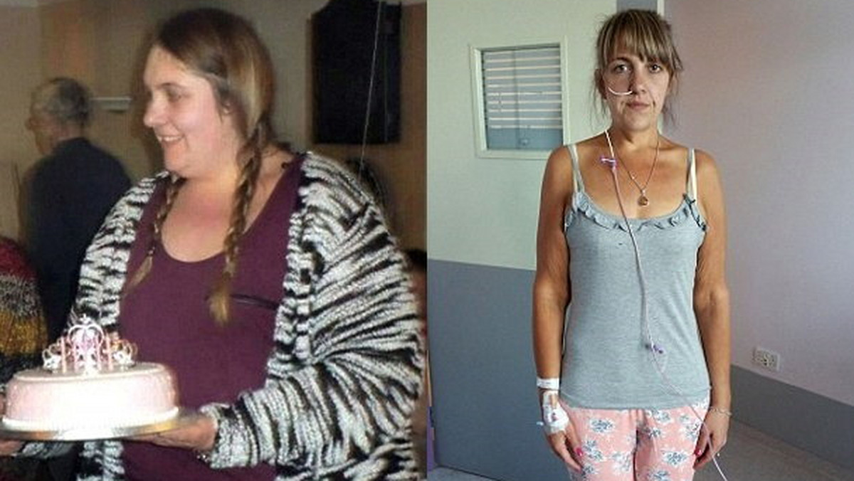 70 kilogramów zrzucone w pół roku - tak drastyczny spadek masy ciała doprowadził kobietę do anoreksji. Dawniej walczyła z otyłością, teraz przyszło jej zmagać się z przeciwną jej chorobą. Jadła 100 kalorii dziennie.