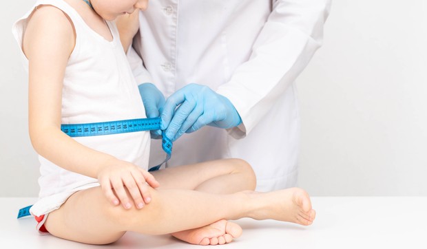 Kvašiorkor je najčešći kod dece, posebno u uzrastu od 3 do 5 godina