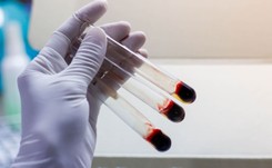 Eksperyment, by spowolnić przebieg stwardnienia rozsianego