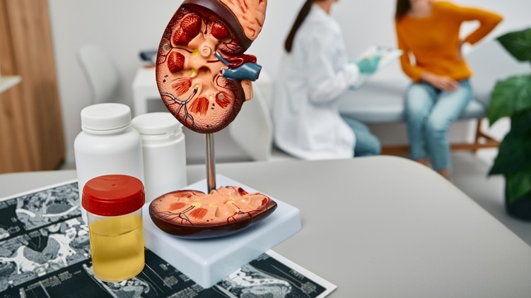 véres vizelet, haeumaturia, vesekő, gyulladás, fertőzés, daganat, vérzészavar, magas vérnyomás, vese
