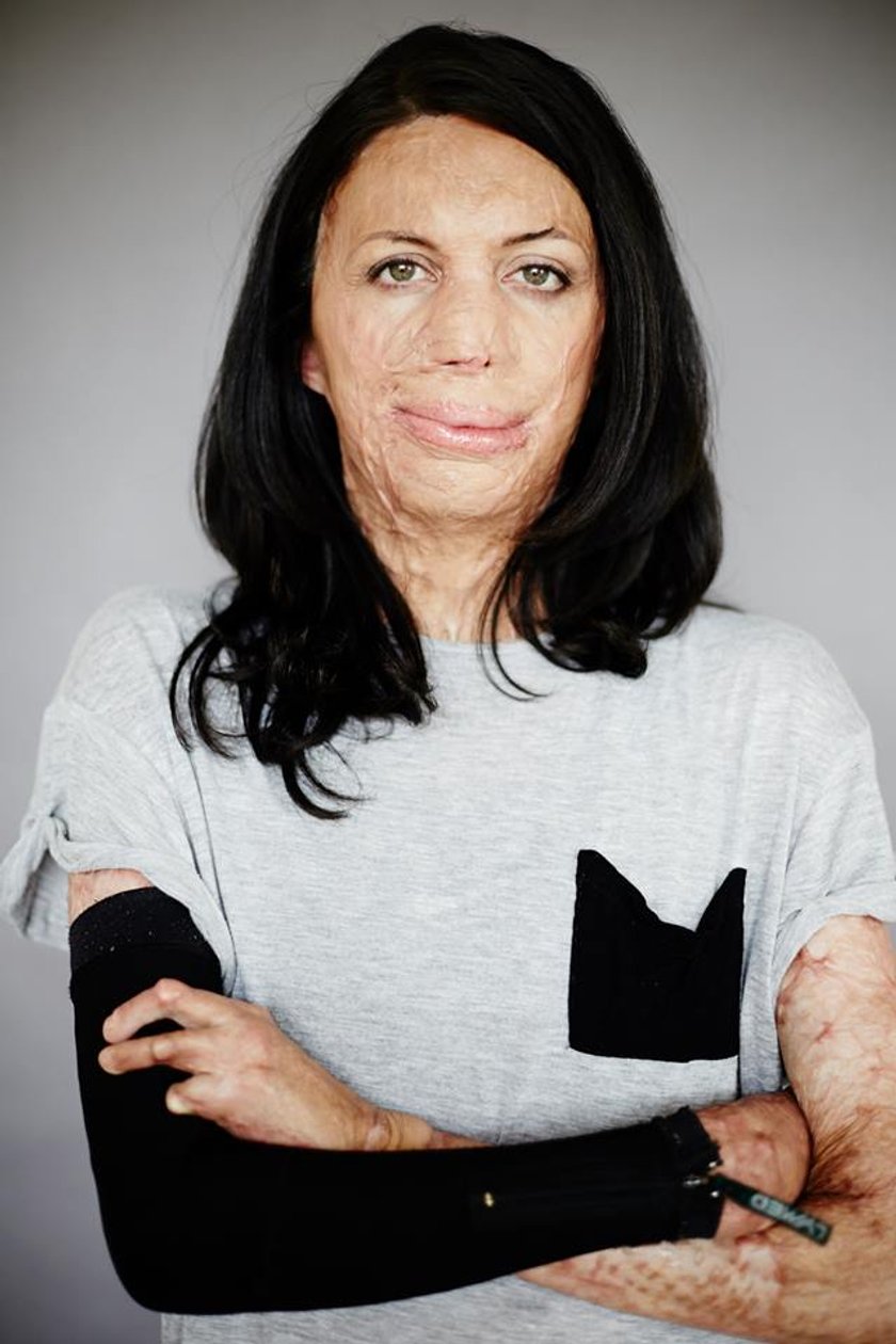 Turia Pitt