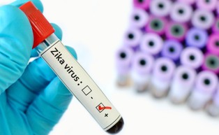 Wirus Zika może wywołać nową pandemię, wystarczy niewielka mutacja [BADANIE]