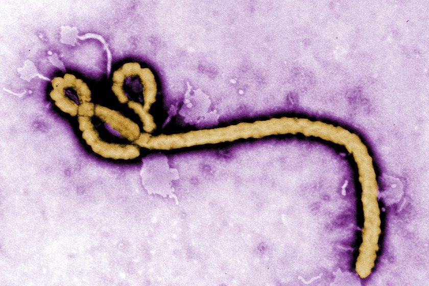 Ebola jest chorobą wywołaną przez wirus z rodziny Filoviridae rodzaju Ebolavirus.