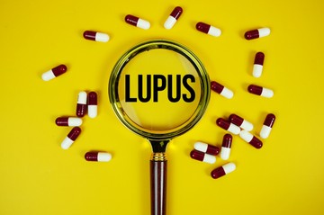 Lupusz – tünetek, diagnózis, kezelés: amit minden érintettnek tudnia kell című cikk nyitóképe