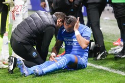 Liga francuska. Skandal w Lyonie. Payet trafiony butelką w głowę [WIDEO]