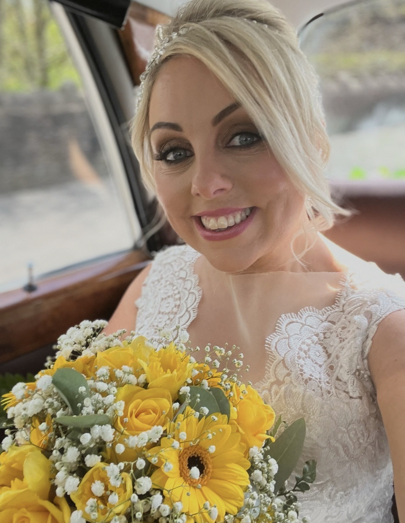 Charlie Beswick sa krátko pred svadbou zobudila s ochabnutou tvárou.