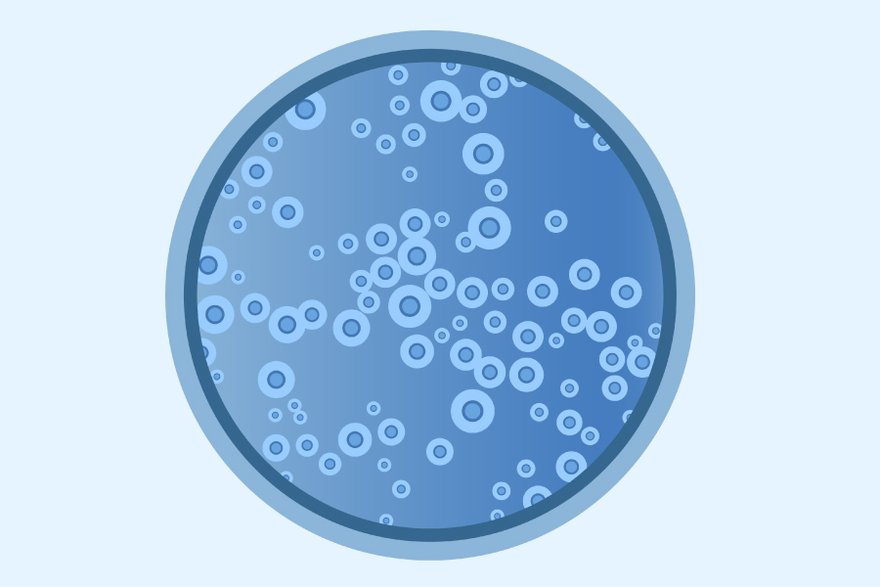 Cryptococcus neoformans