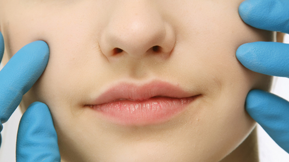 Obecnie jedynymi w pełni skutecznymi sposobami uniesienia opadających kącików ust oraz wypełnienia bruzd nosowo-wargowych są zabiegi medycyny estetycznej.