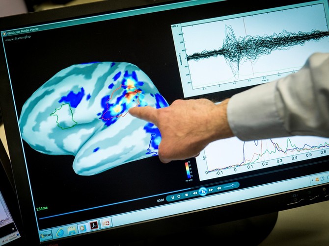 Osim što otkriva da li je sa varenjem sve u redu, kvantni pregled pokazuje i stanje u crevima, kao i da li imate predispoziciju za gastritis i čir na želucu ili dvanaestopalačnom crevu