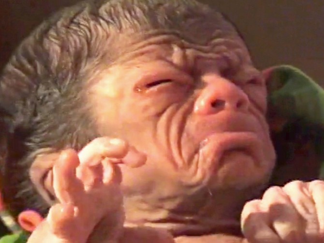 122486_bebaprofimedia0301262514