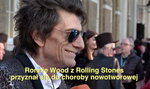 Ronnie Wood z Rolling Stones przyznał się do walki z nowotworem płuc
