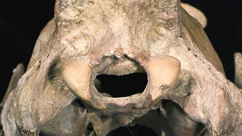 Deformisana rupa u lobanji