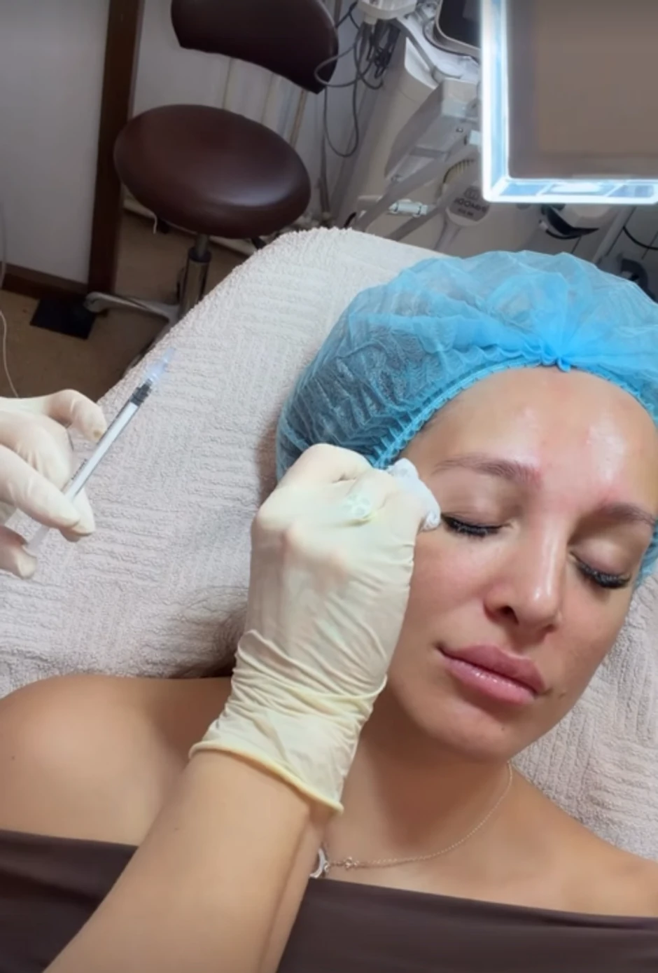 Luna Đogani ubrizgava botoks u lice, snimala se tokom tretmana