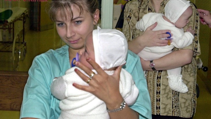 Na archívnej fotografii je Lucia a Andrea Tóthové po dvoch operáciách a piatich mesiacoch pobytu, kedy 18. júla 2000 opustili Detskú fakultnú nemocnicu s poliklinikou (DFNsP) v Bratislave 