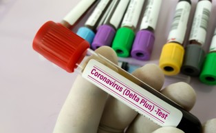 Fala zakażeń Deltą dotarła do 17 regionów Chin. Zakończyły się testy przesiewowe w Wuhanie