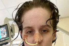 ANA (27) NIJE MOGLA DA URINIRA 6 GODINA! Lekari joj nisu verovali, a onda su otkrili OVU NEIZLEČIVU BOLEST koja najčešće pogađa MLADE: "Pratiće me do kraja života"