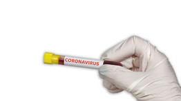 Most jött: újabb jégkorongozók koronavírus-tesztje lett pozitív
