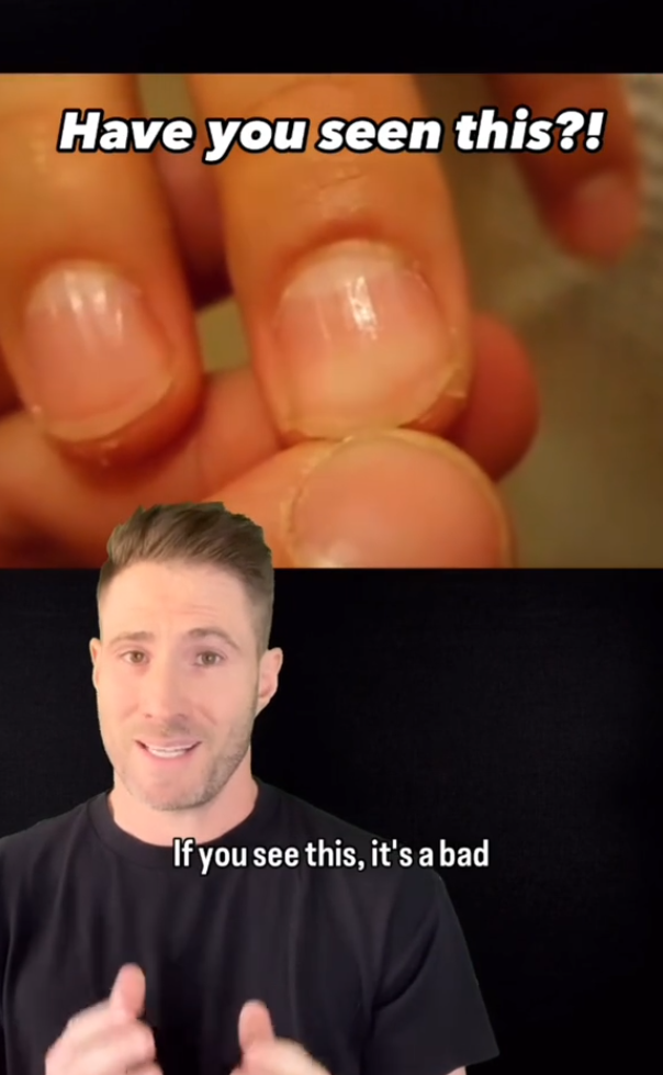 Lekár varoval pred príznakom, ktorý môže naznačovať vážny zdravotný stav.