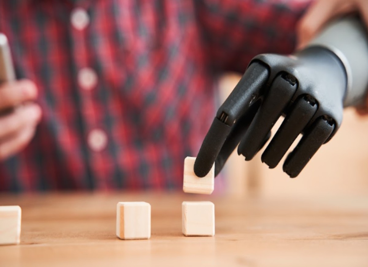 Bioniczna dłoń Esper Hand stworzona przez Esper Bionics. Z takich protez korzystają ukraińscy weterani