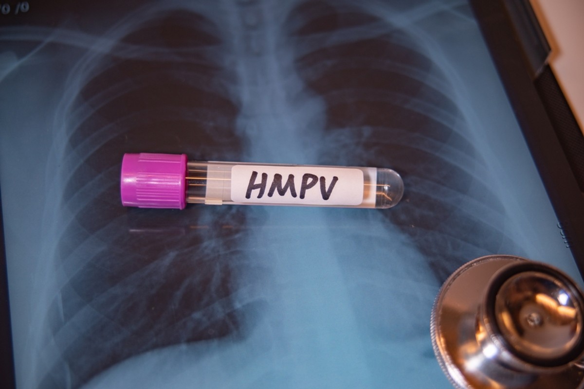 wirus hMPV, wirus, hMPV