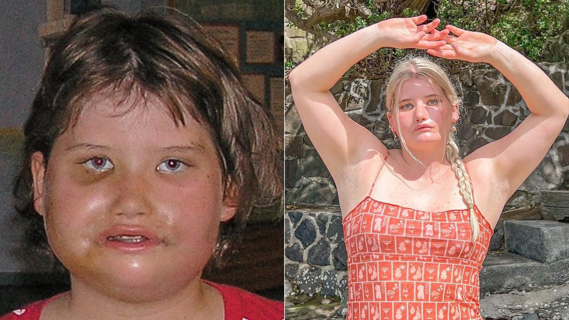 Od malička sa nedokáže usmiať, no dnes je z nej modelka.