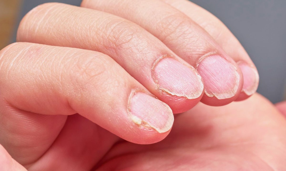 Paznokcie pękają na potęgę? Wsmaruj to kolagenowe serum. Odrosną mocne jak stal