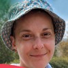 Milica Milosavljević ima agresivan tumor mozga i potreban joj je novac za lečenje
