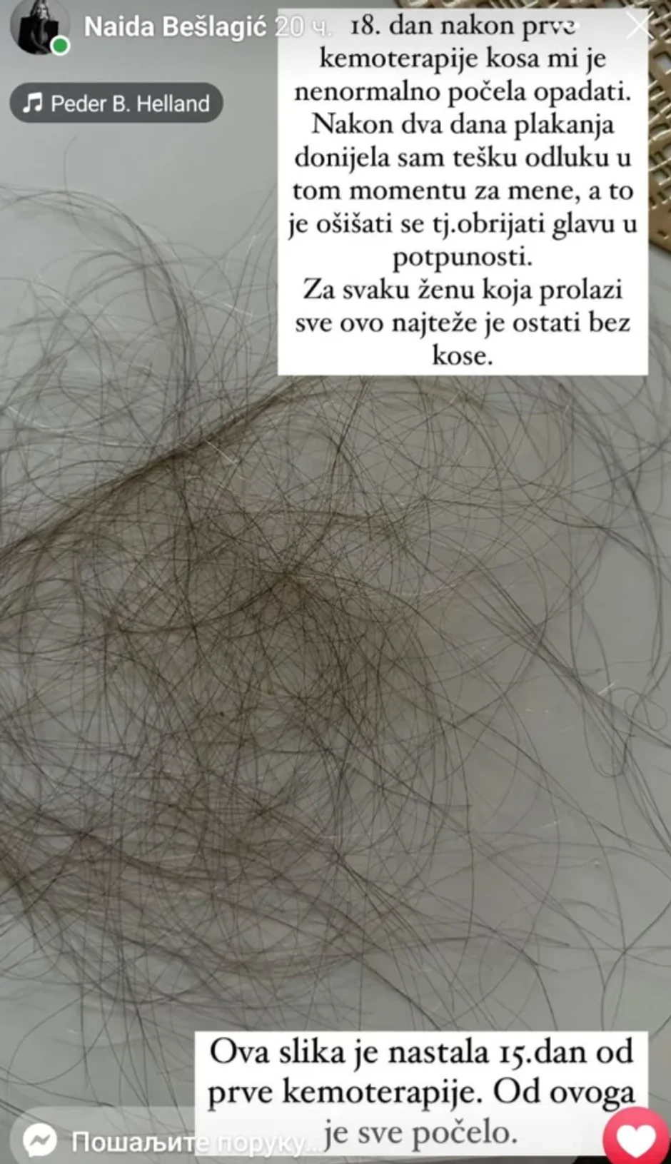 Naida Bešlagić o borbi sa rakom