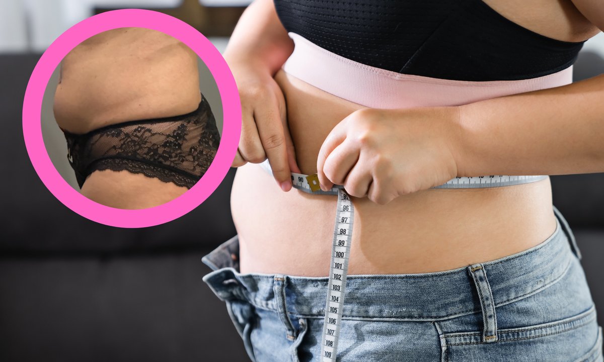 Wystający brzuch bez nadwagi? To może być sygnał przesuniętej miednicy