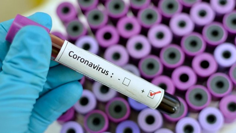 Ghana confirms four new cases of coronavirus