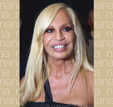 20097_36811-donatella-versace-rossz-plasztika-sl-d0000CF7216050b3b986b