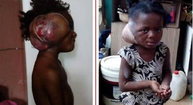 This young kid, Kehinde Adebiyi, needs our assistance