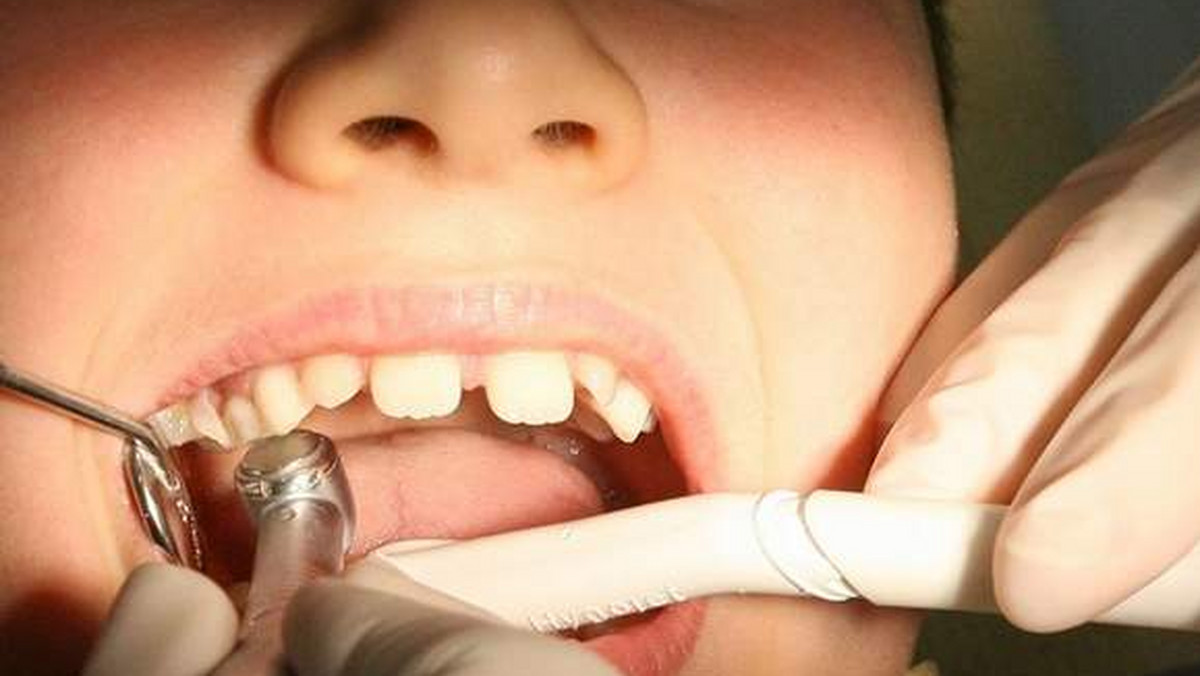 Nowiny24: Co czwarte dziecko w tym wieku ma próchnicę w co najmniej jednym mleczaku. Prawie 29 proc. dzieci ma ubytki w 4, 5 lub 6 zębach. Na tym nie koniec, bo aż co trzeci 6-latek ma do leczenia 7 lub więcej zębów mlecznych!