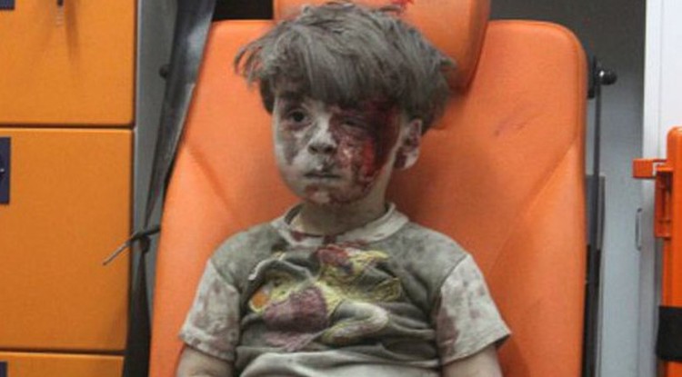 Omran Daqneesh Aleppóban