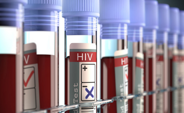 Francja: Osoby zarażone HIV będą mogły służyć w armii