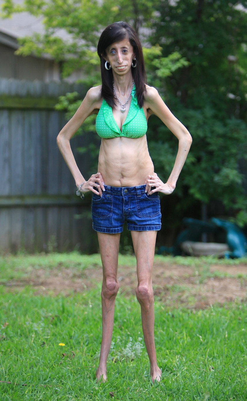 Skinniest person ever