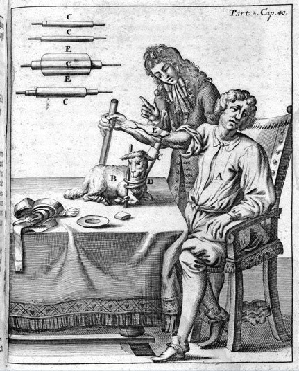 Transfuzja zwierzęcej krwi z 1667 r. 