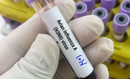 ptasia grypa zdziesiątkowała słonie morskie na atlantyku. "wyniki są d