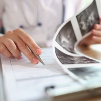 Méhpolip: 6 jel is utalhat rá, hogy már elindult a sejtburjánzás a méhben