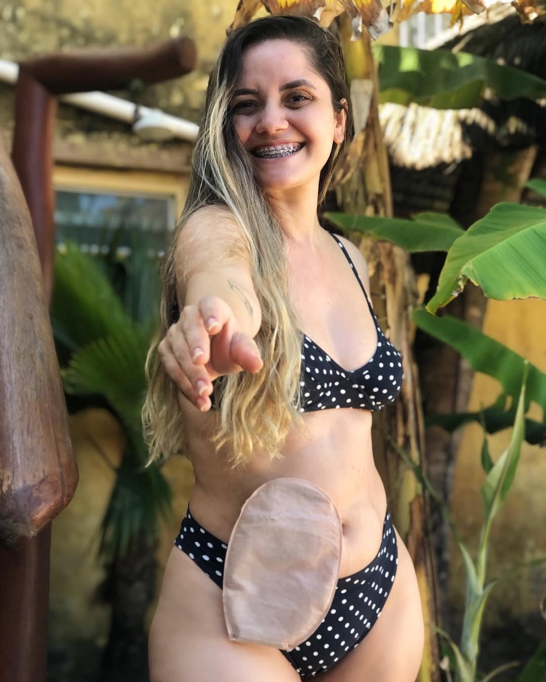 Brazílska influencerka Jéssica Daugirdas zomrela po dlhom boji s rakovinou hrubého čreva.